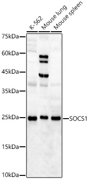 Rabbit anti-SOCS1 Polyclonal Antibody