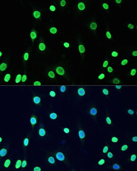 Rabbit anti-Acetyl-DNMT1-K1127/K1129/K1131/K1133 Polyclonal Antibody