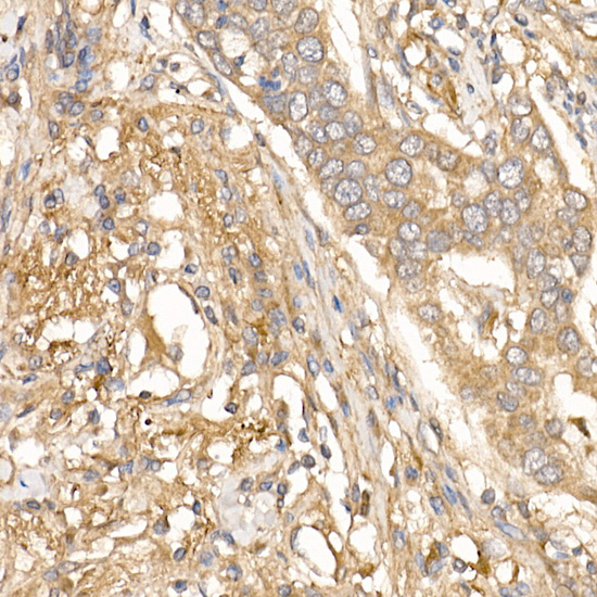 Rabbit anti-TGFBI Polyclonal Antibody
