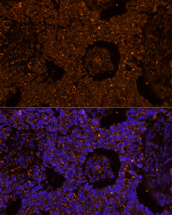 Rabbit anti-ZP2 Polyclonal Antibody
