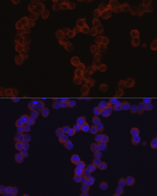 Rabbit anti-TGFBI Polyclonal Antibody