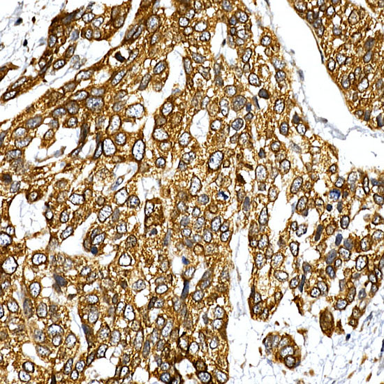 Rabbit anti-VAPB Polyclonal Antibody