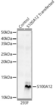 Rabbit anti-S100A12 Polyclonal Antibody