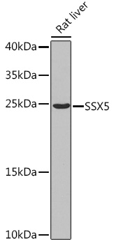 Rabbit anti-SSX5 Polyclonal Antibody