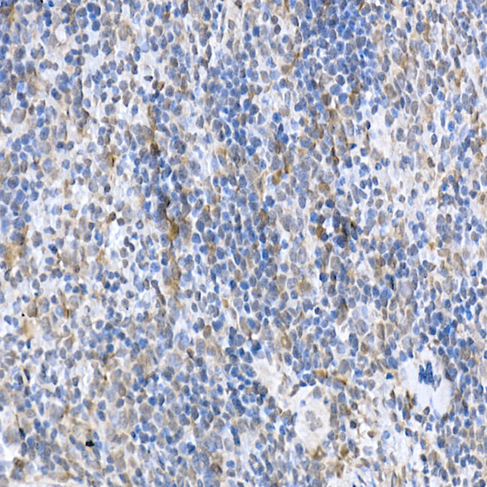 Rabbit anti-SOCS1 Polyclonal Antibody
