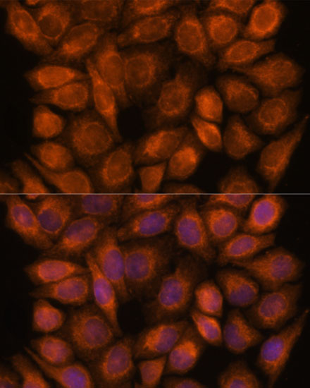 Rabbit anti-SNX15 Polyclonal Antibody