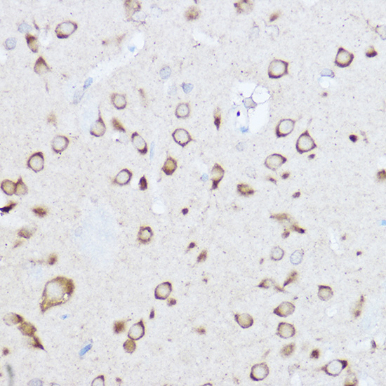 Rabbit anti-YTHDF3 Polyclonal Antibody