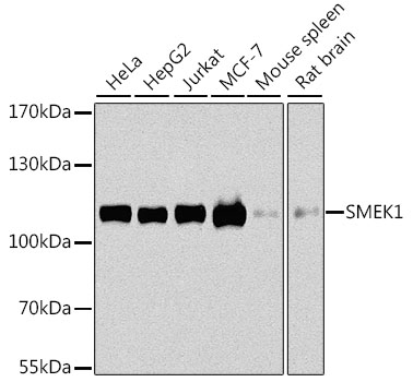 Rabbit anti-SMEK1 Polyclonal Antibody