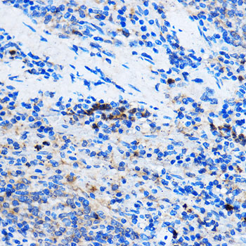 Rabbit anti-CHEK1 Polyclonal Antibody