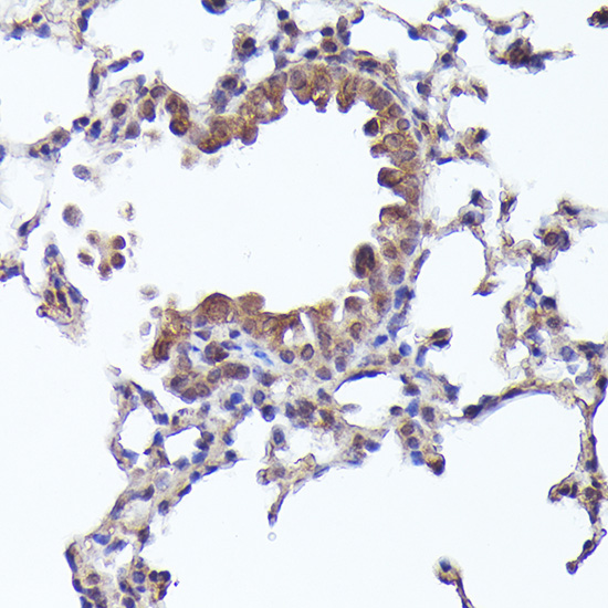 Rabbit anti-CRCP Polyclonal Antibody