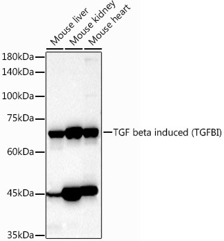 Rabbit anti-TGFBI Polyclonal Antibody