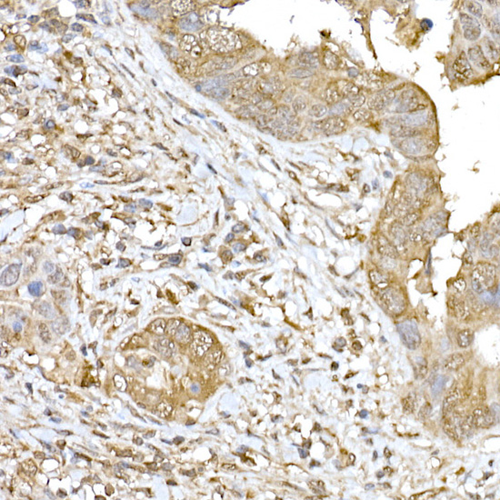 Rabbit anti-SOCS1 Polyclonal Antibody