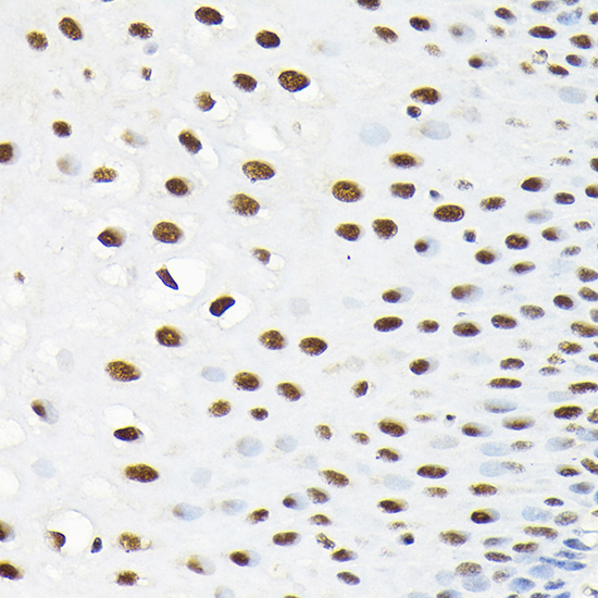 Rabbit anti-KPNA3 Polyclonal Antibody