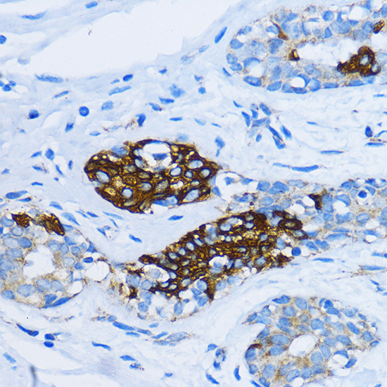 Rabbit anti-EEA1 Polyclonal Antibody