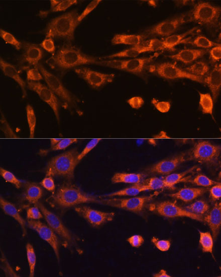 Rabbit anti-SUPV3L1 Polyclonal Antibody