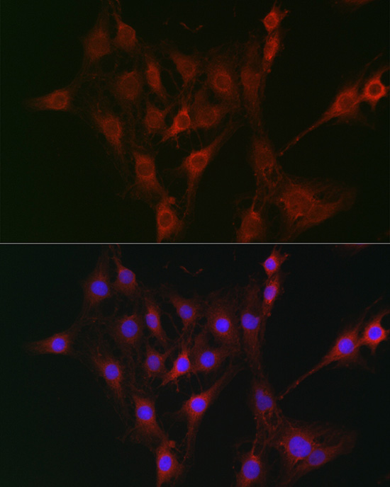 Rabbit anti-TAP2 Polyclonal Antibody