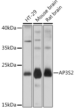 Rabbit anti-AP3S2 Polyclonal Antibody