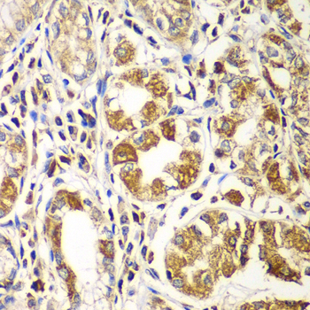 Rabbit anti-RAC1/2/3 Polyclonal Antibody