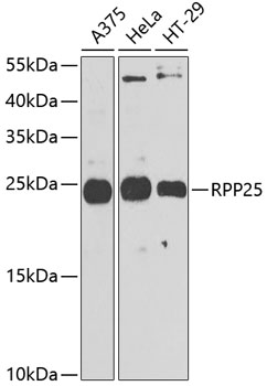 Rabbit anti-RPP25 Polyclonal Antibody