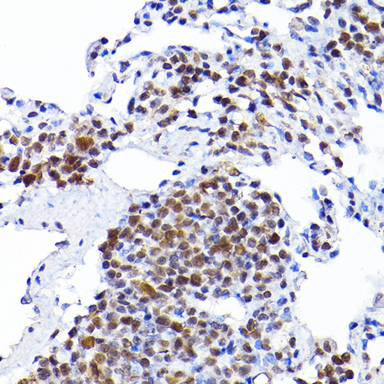 Rabbit anti-RCC1 Polyclonal Antibody