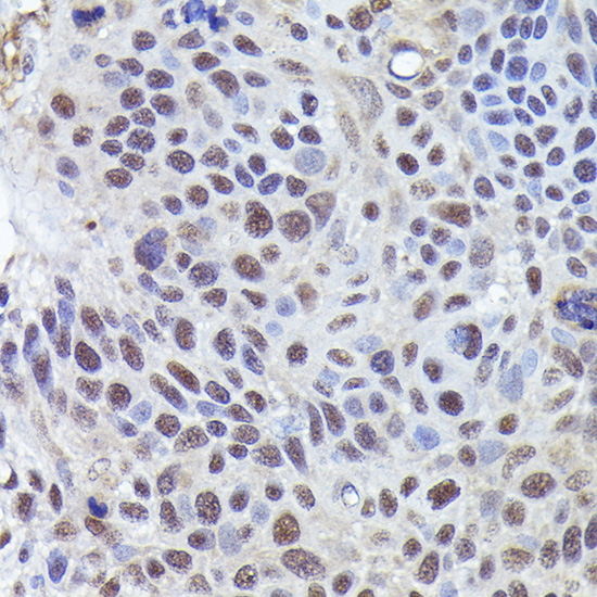 Rabbit anti-CRCP Polyclonal Antibody