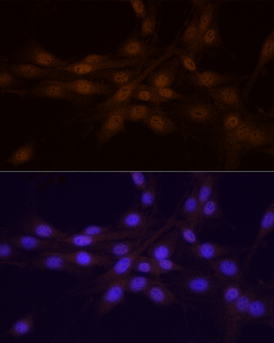 Rabbit anti-CHEK1 Polyclonal Antibody