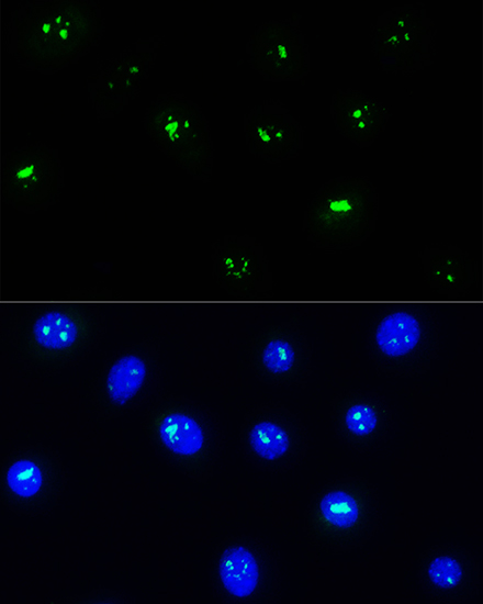 Rabbit anti-NOP58 Polyclonal Antibody