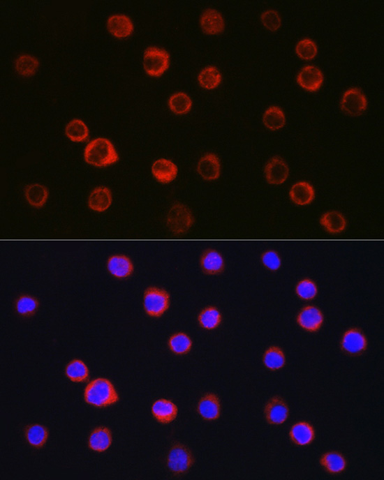 Rabbit anti-ITGAM Polyclonal Antibody