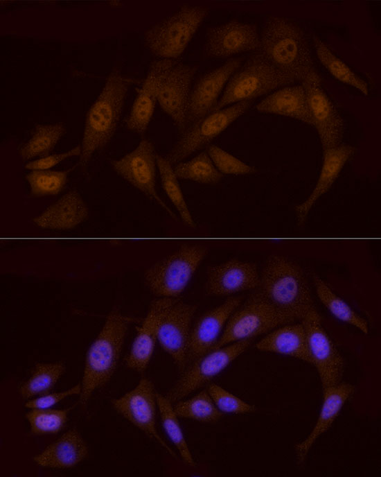 Rabbit anti-CHEK1 Polyclonal Antibody
