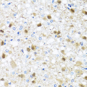 Rabbit anti-ZBTB17 Polyclonal Antibody