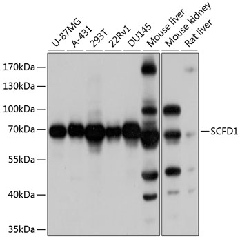 Rabbit anti-SCFD1 Polyclonal Antibody