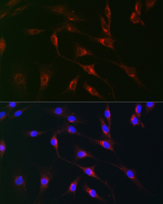 Rabbit anti-MAOB Polyclonal Antibody