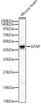Rabbit anti-GFAP Polyclonal Antibody