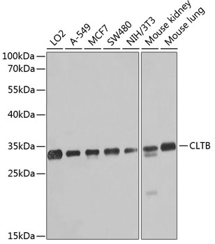 Rabbit anti-CLTB Polyclonal Antibody