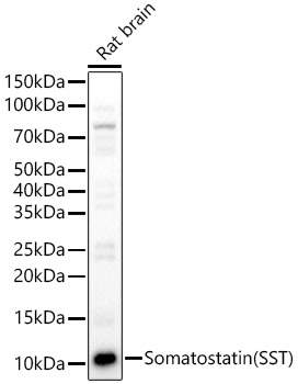 Rabbit anti-SST Polyclonal Antibody