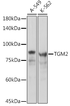Rabbit anti-TGM2 Polyclonal Antibody