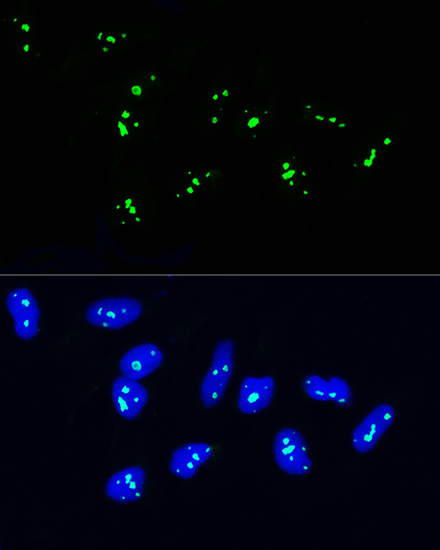 Rabbit anti-NOP58 Polyclonal Antibody