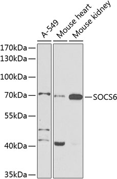 Rabbit anti-SOCS6 Polyclonal Antibody