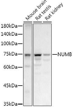 Rabbit anti-NUMB Polyclonal Antibody