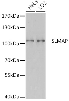 Rabbit anti-SLMAP Polyclonal Antibody