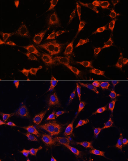 Rabbit anti-ITPR3 Polyclonal Antibody