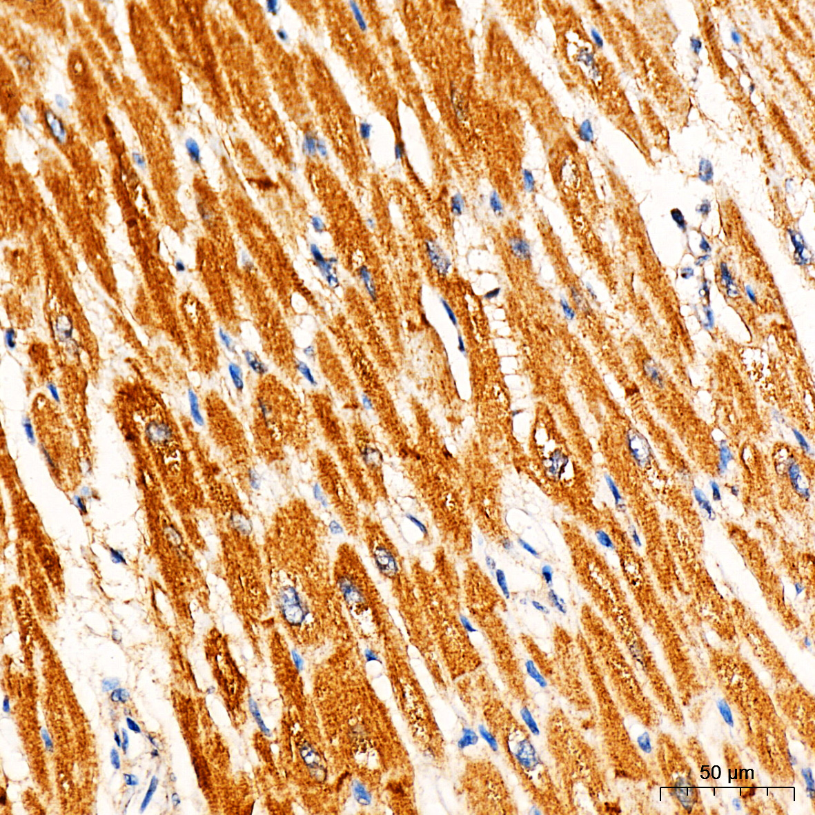 Rabbit anti-RYR2 Polyclonal Antibody
