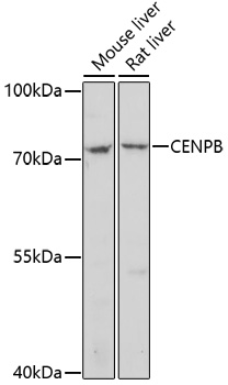 Rabbit anti-CENPB Polyclonal Antibody