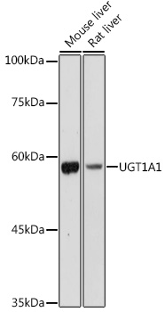 Rabbit anti-UGT1A1 Polyclonal Antibody