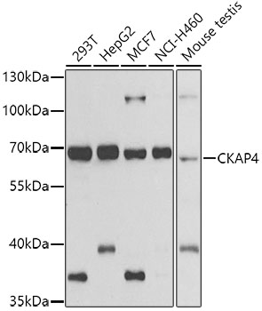 Rabbit anti-CKAP4 Polyclonal Antibody