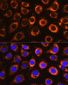 Rabbit anti-MAOB Polyclonal Antibody