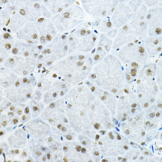 Rabbit anti-GATAD2B Polyclonal Antibody