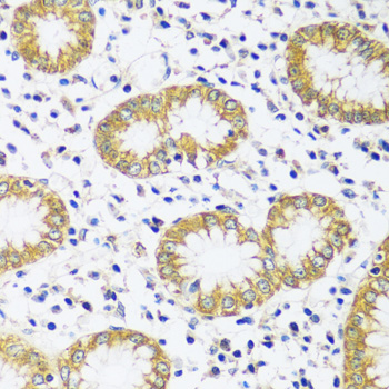 Rabbit anti-CADPS Polyclonal Antibody