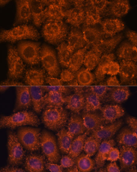 Rabbit anti-INMT Polyclonal Antibody