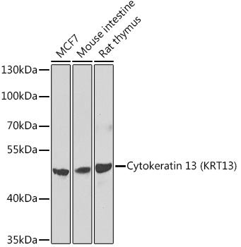 Rabbit anti-KRT13 Polyclonal Antibody